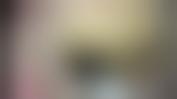 Technique of placement of Lumen Opposing Metal Stent in Walled Off Pancreatic Necrosis (WOPN)