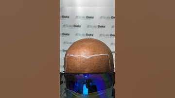 Get rid of baldness with this procedure called scalp micropigmentation #scalpmicropigmentation #smp