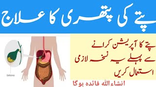 Pitay Me Pathri Ka Ilaj | Gallstones Symptoms And Treatment |  Gallbladder Stone Treatment