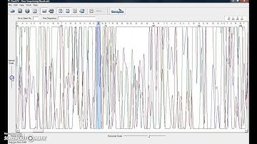 Sequence Analysis using Finch TV and BLAST