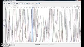 Sequence Analysis using Finch TV and BLAST screenshot 3