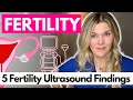 Five fertility ultrasound findings what does your doctor mean should you be concerned