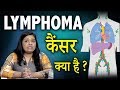 लिम्फोमा कैंसर के बारे में ये जानकारी है काफी फायदेमंद |  Lymphoma Cancer In Hindi | Life Care