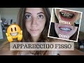 APPARECCHIO FISSO | Aggiornamento dopo sei mesi