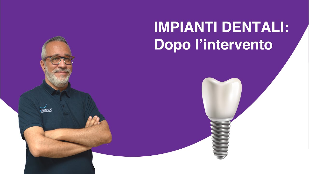 Impianti dentali - Come comportarsi dopo l'intervento