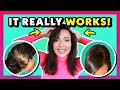 SCALP MASSAGE FOR HAIR LOSS (Best Scalp Massage for Hair Growth)