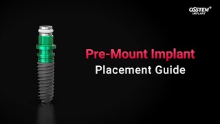 Pre-Mount Implant Placement Guide