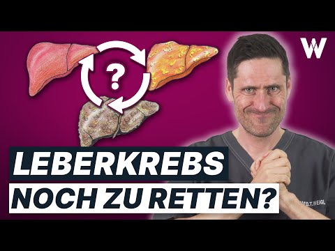 Leberkrebs: Erste Warnzeichen schnell erkennen! Mit und ohne Alkohol - es kann uns Alle treffen!