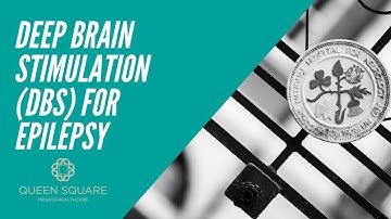 What is Deep Brain Stimulation (DBS) treatment for epilepsy? - Dr Dominic Heaney