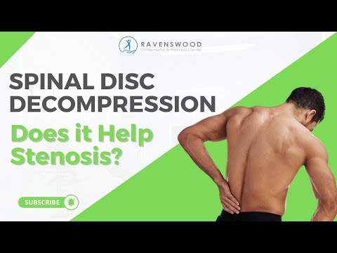 Spinal Decompression Help With Stenosis?