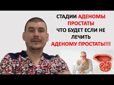 СТАДИИ АДЕНОМЫ ПРОСТАТЫ. ЧТО БУДЕТ ЕСЛИ НЕ ЛЕЧИТЬ АДЕНОМУ ПРОСТАТЫ!!!