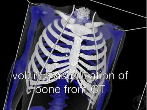 Augmented Reality Magic Mirror using Kinect