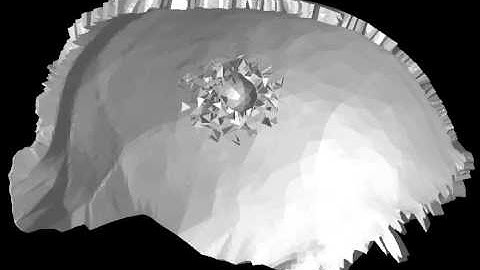 Finite element simulation of bullet impacting skull (2/2)