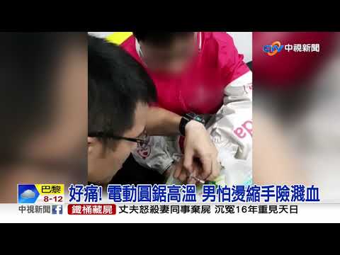 戒卡手指腫脹求救 消防"電動圓鋸"切割險濺血│中視新聞 20201102
