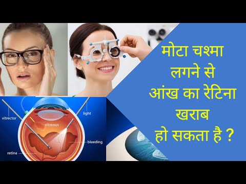 वीडियो: क्या आपको रतौंधी के लिए चश्मे की जरूरत है?