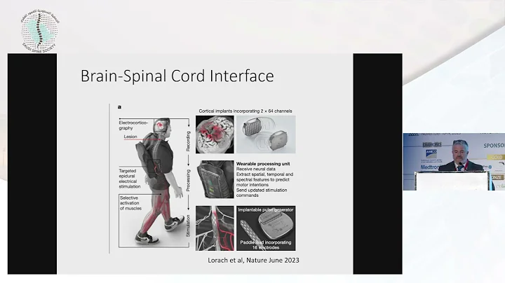 Interfacing the Brain with a Computer for Spinal Cord Injury (and everything else)by Dr. Adam Sachs