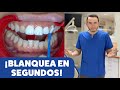 BLANQUEA TUS DIENTES EN SEGUNDOS ¿Ya es una realidad? | Tal como lo viste en Instagram