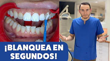 ¿Qué utilizan los famosos para blanquearse los dientes?