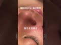 TikTokで1100万回再生した話題の韓国式3D毛穴洗浄がすごすぎる #shorts #毛穴 #blackheads