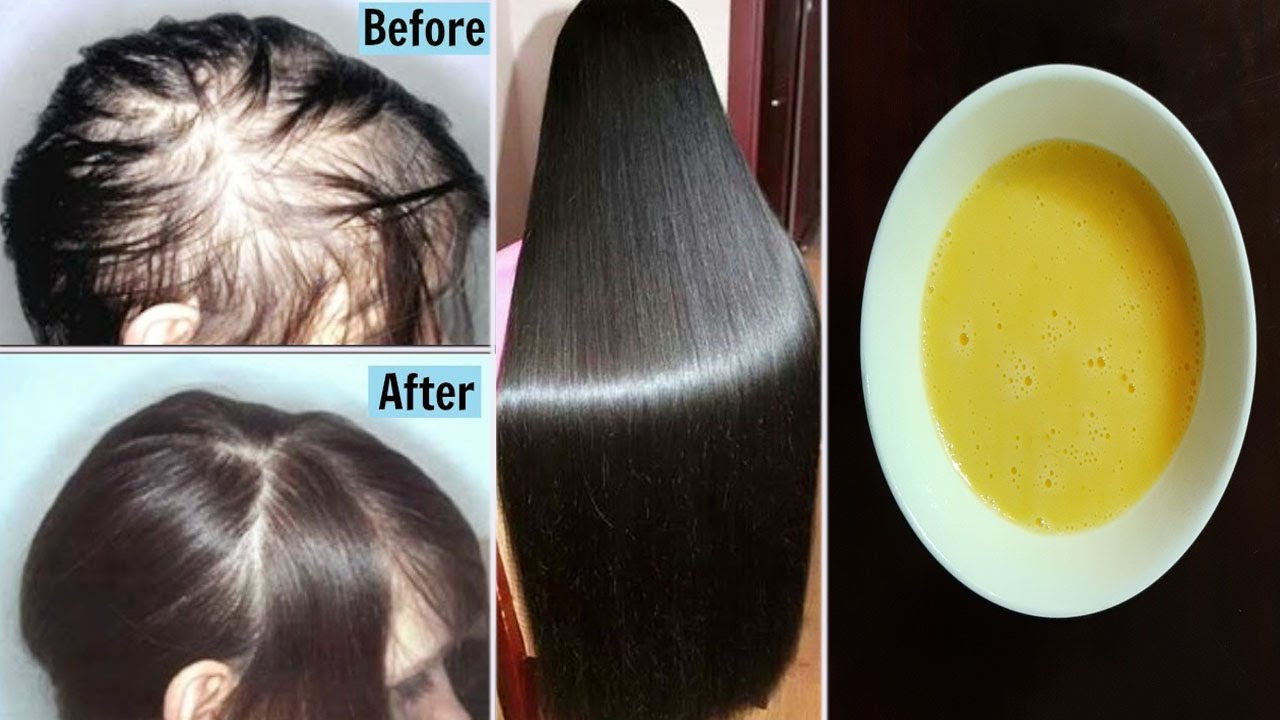 DO THIS! Your Hair Will Grow Extreme Fast and Stop Hair Loss Hair