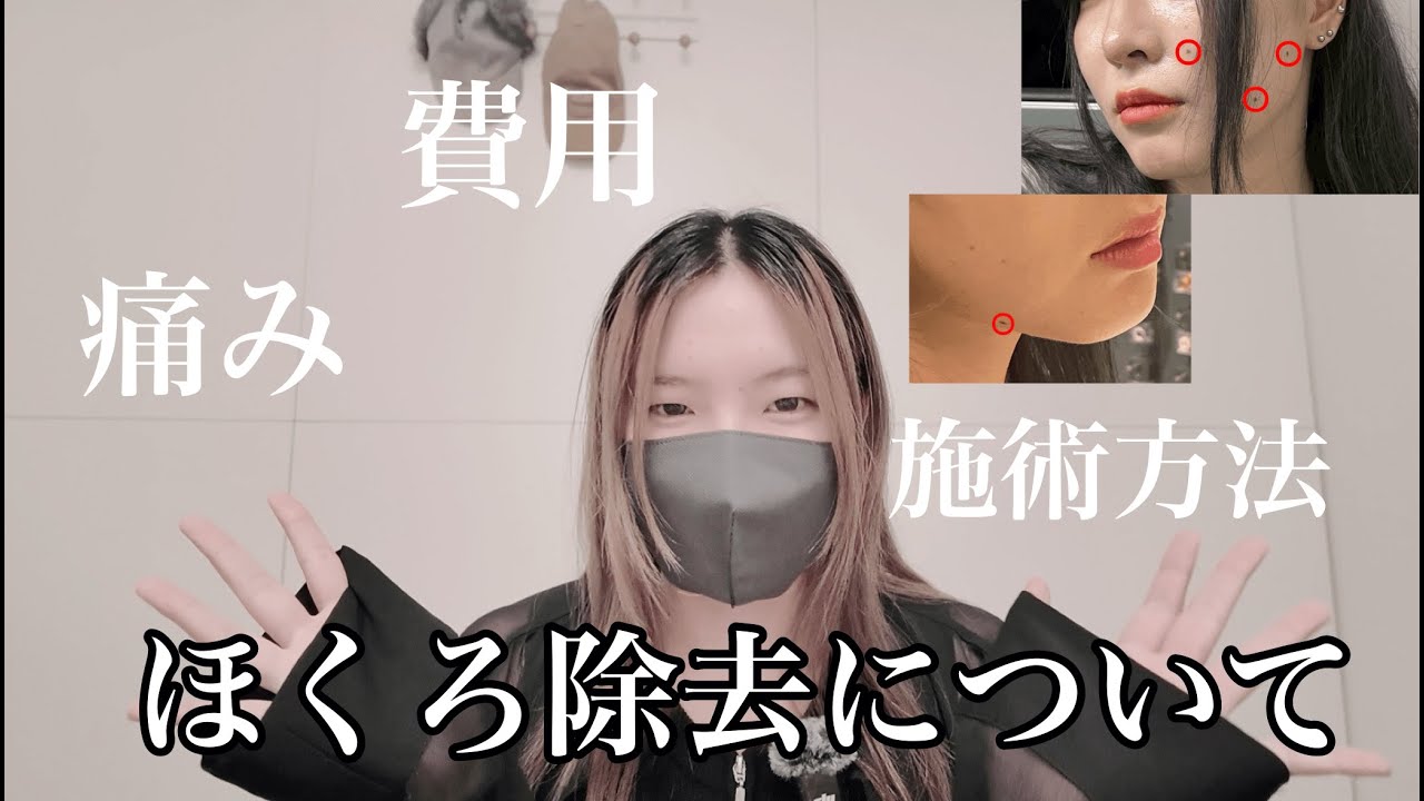 【ほくろ除去】ついに長年の悩みを解消✨️ほくろ除去について徹底解説！｜悩んでる方必見👀
