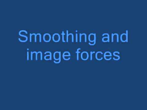 MRI Bone Segmentation Using Deformable Models and Shape Priors