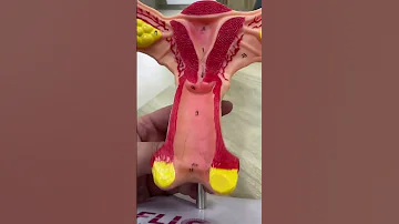 اعرفي أين يقع غشاءالبكاره 