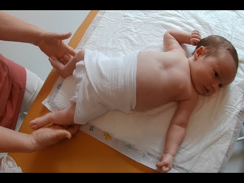 Дисплазия тазобедренного сустава у новорожденных. Широкое пеленание.