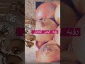 رؤيه البصل للحامل
