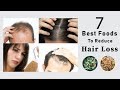 7 Foods That Fight Hair Loss - 7 Foods that stop Hair Loss- top 7 foods to prevent Hair Loss