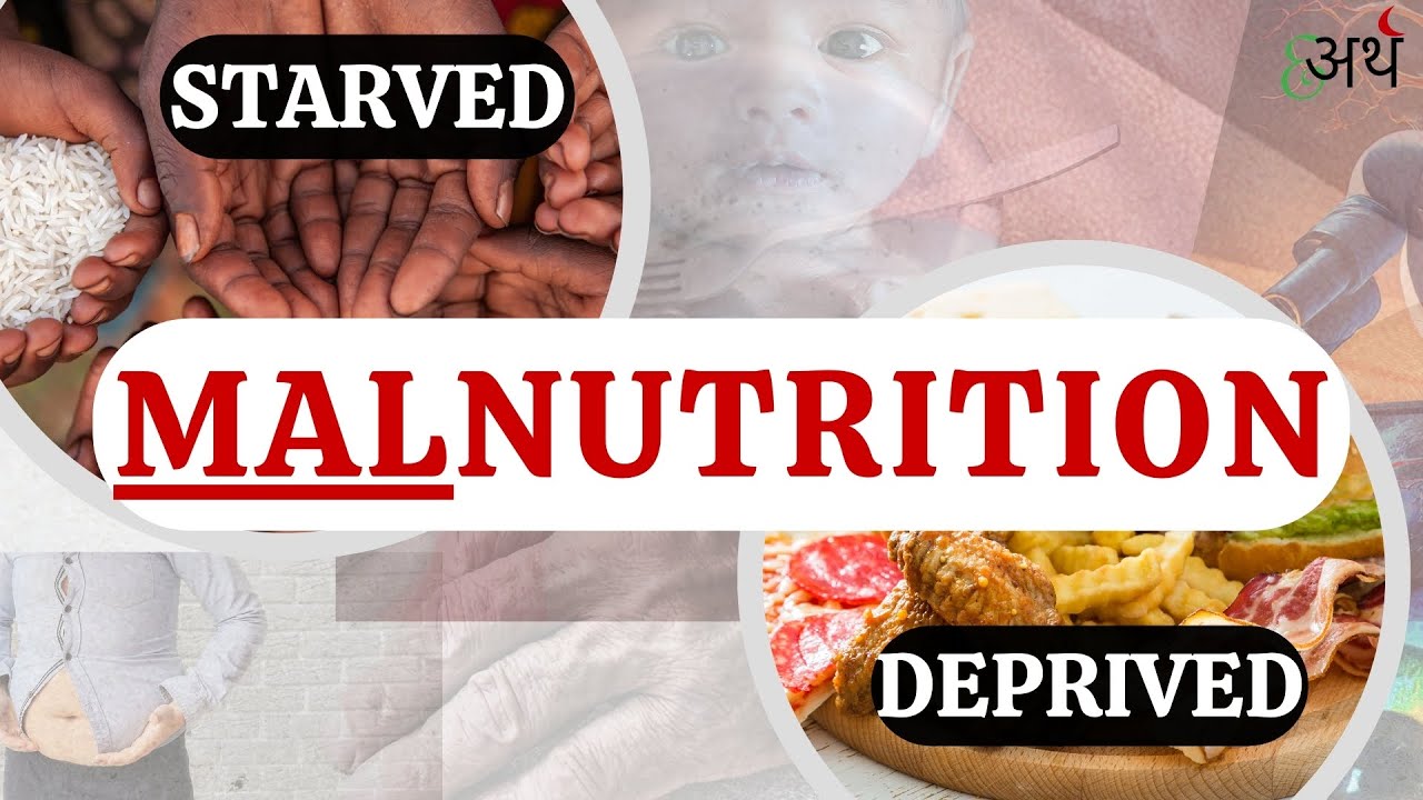 Malnutrition| Overnutrition and Undernutrition| Unhealthy Food ...