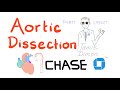 Aortic Dissection | Jamie's Story