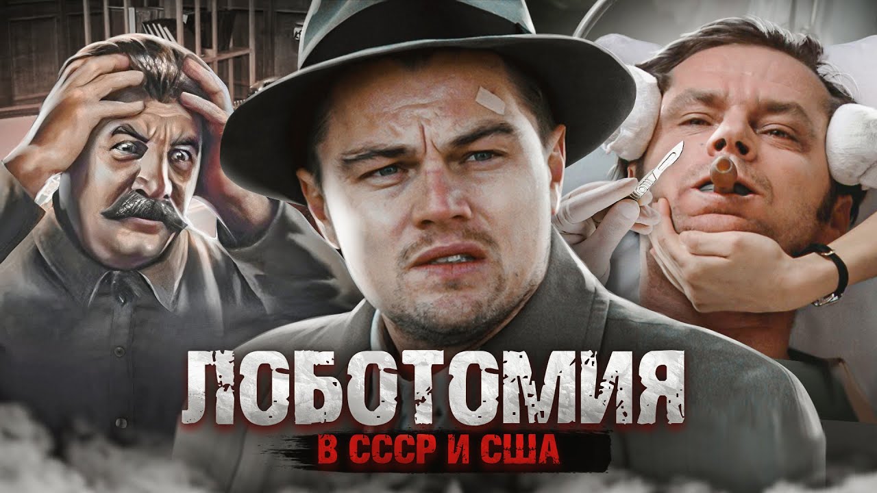 Лоботомия l СССР vs США - YouTube