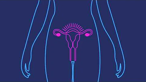 How Effective is the Birth Control Shot | Planned Parenthood Video