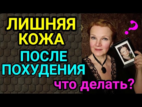 лишняя кожа после похудения / как я похудела на 94 кг и улучшила здоровье