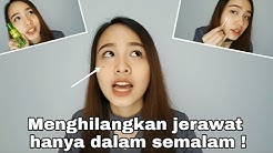 Cara Menghilangkan Jerawat Dalam Satu Malam ! + Ngobrol Soal Jerawat | Savira Millenita  - Durasi: 15.14. 