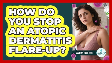 How Do You Stop An Atopic Dermatitis Flare-up? - Eczema Help Hub