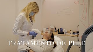Tratamento de Pele VLOGMAS 3| Mafalda Sampaio