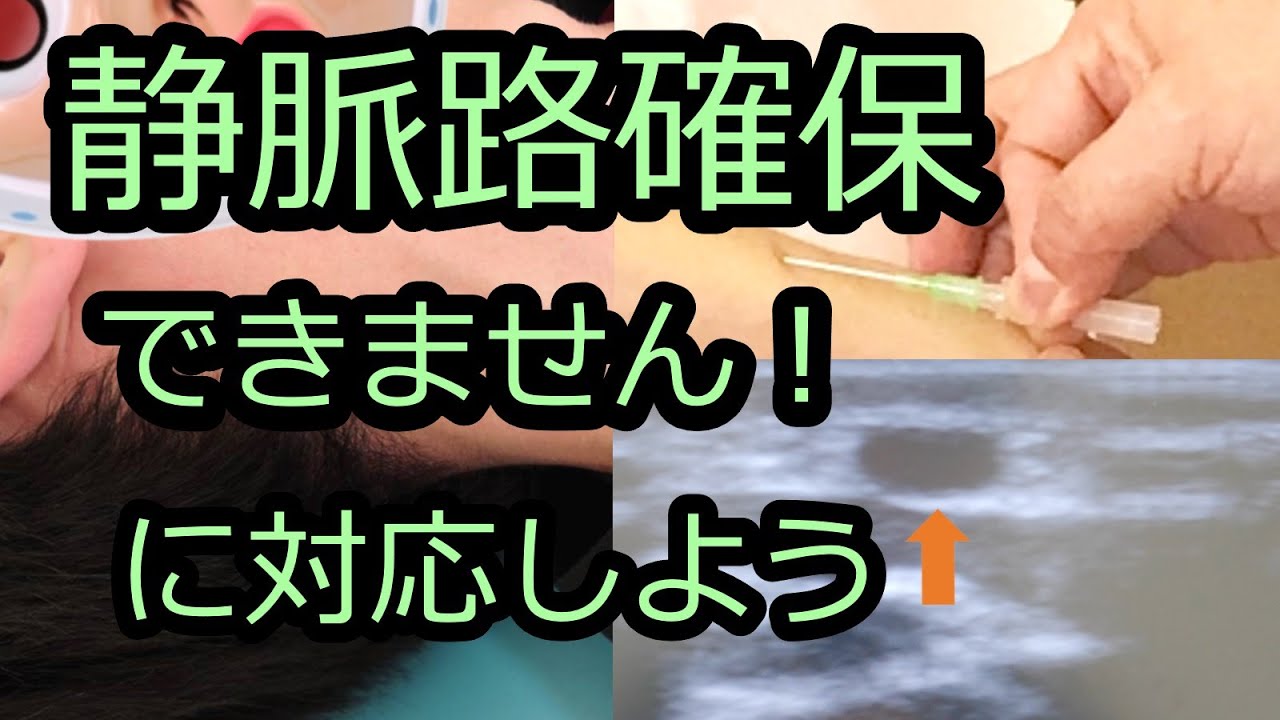hq720.jpg?sqp=-