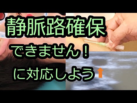 ルート確保・血管穿刺「超」入門―60分の動画でめきめき体得!末梢静脈確保、動脈確保、中心静脈確保 Amazon.co.jp: ルート確保・血管穿刺「超」入門―60分の動画で