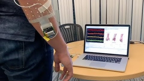 An armband to control prosthetic hands