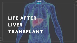 Life after Liver Transplant