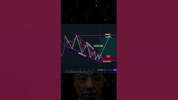 Day Trading! #shorts #crypto #forex #trading #patterns
