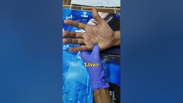 Acupressure points ~ Kidney, Liver, Testosterone, gas ~ Dr. Parag Sharma| Part -3 | Raksha Sutra