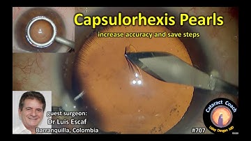 capsulorhexis pearls to increase accuracy and efficiency in cataract surgery