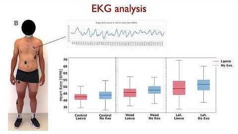 AHFE 2021 - Using exoskeletons to assist medical staff during prone positioning of COVID-19 patients