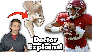 Doctor Explains Tua Tagovailoa Hip Dislocation Injury and Compares to Bo Jackson