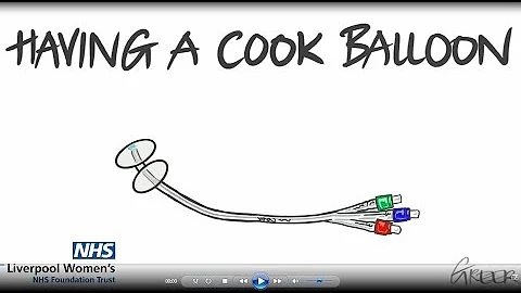 LWH Having a cook balloon