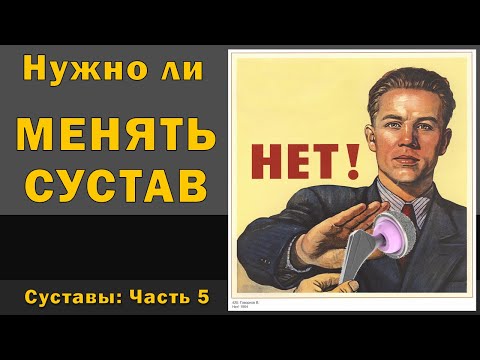 Почему стоит отложить операцию по замене сустава? [S05E05]