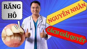 NGUYÊN NHÂN RĂNG HÔ Và Cách Giải Quyết HIỆU QUẢ NHẤT!!! |Dr Cường Offical